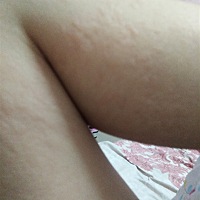 孕期皮肤过敏，全身痒，去医院医生说怀孕也没办法，只有观察两天看看，怎么办，求教