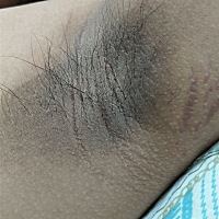 怀孕快7个月了，肚子上突然有红点点，特别痒，有没有孕妈妈知道是什么情况的呀！！！！  咯吱窝黑的不像...