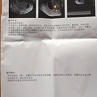 如果我妹明天去检查还是没有胎心，还要不要再等等呢？因为第一个也是没有胎心打掉