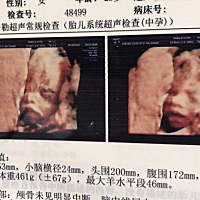 有会看男女的吗？三维时的照片附上两张