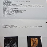 NT顺利通过，姐妹们来猜猜男宝还是女宝，娱乐娱乐。😊