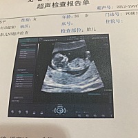 今天做了nt，孕三个月了，看这彩超像女宝呢，那