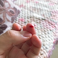 都不知道扎了几十次手指，