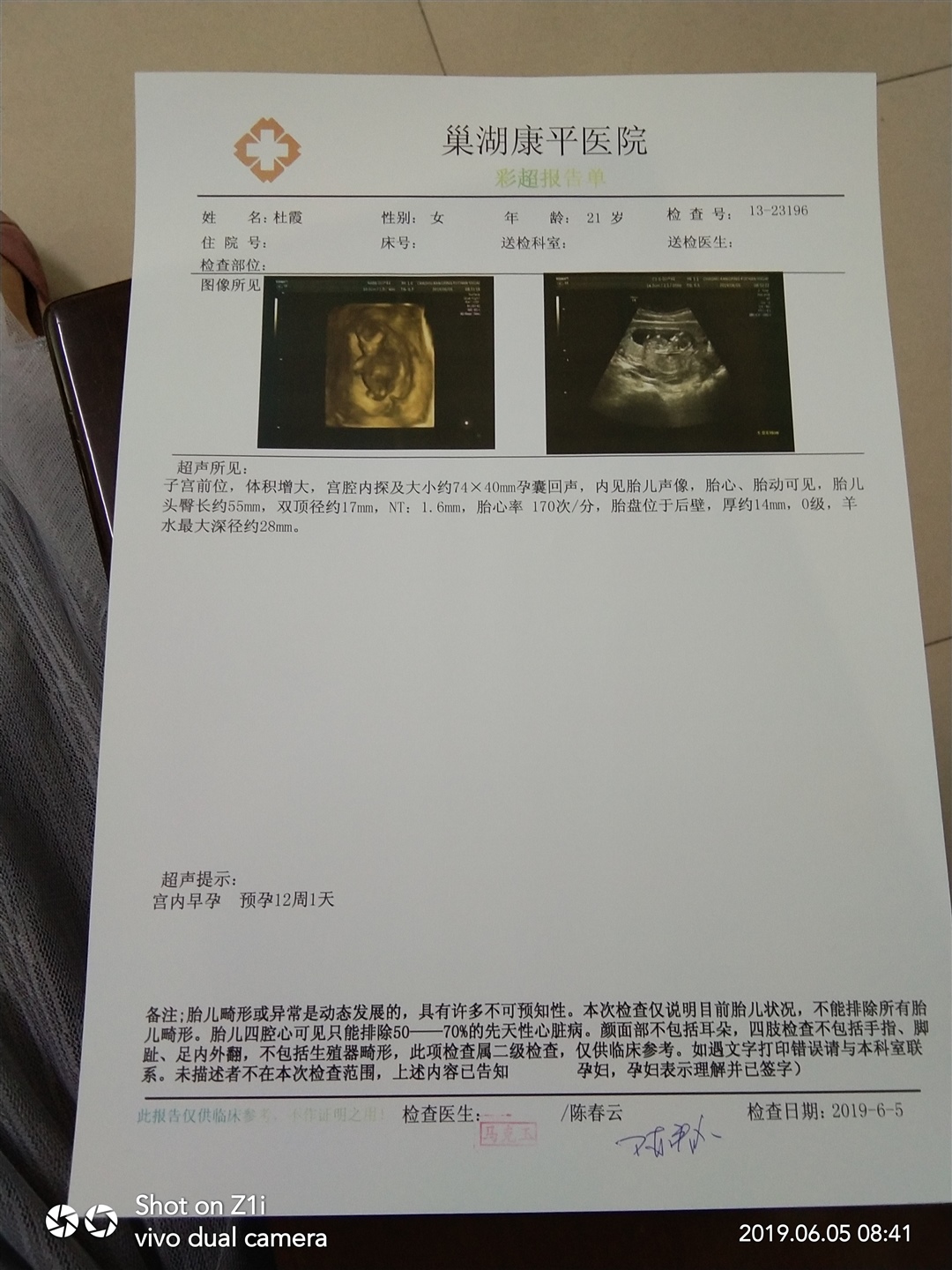 是男孩还是女孩