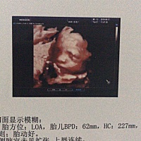 能看的出来是男孩子还是女孩子吗？