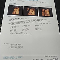 像男孩还是女孩呢，大家帮忙看看