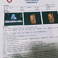 大家帮我看看是男宝还是女宝