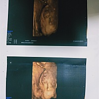 帮我看一下是男宝还是女宝