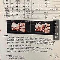 l宝妈们可以看出来男女吗？已经知道一个女孩，