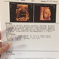 大神们帮看看男女