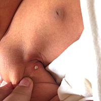 求助贴，各位宝妈们， 宝宝这是起的啥  在线等， 急