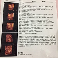 男宝女宝？