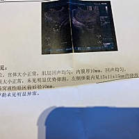 今天去做卵泡监测，什么时候可以安排了呢，还需要再监测吗？