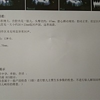 今天刚做的NT检查，好奇宝宝的性别，有会看的吗？求告知，谢谢！