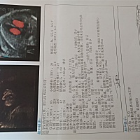 各位孕妈你们好，你们的思维单子看的好清楚，我的怎么都看不明白，医生说一切正常，，但是实在看不明白...