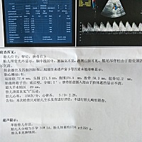 医生说胎位不正，怎么解决啊，我不想抛妇产