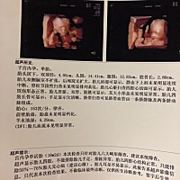 亲们，18周做的四维，帮忙看看男孩 还是女孩？谢谢🙏