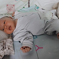 宝宝黄疸重怎么办     都过了30多天了还是很黄