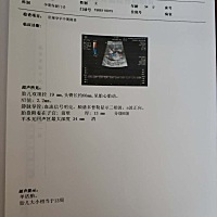 好像哪里看到过胎儿体重计算的软件，有宝妈可以分享一下吗