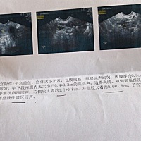 （宫腔内有0.4*0.3cm的高回声，边界尚清 ）这是什么