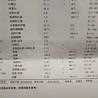 今天做NT检查尿蛋白高出太多  会不会有什么毛病啊