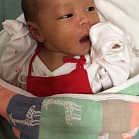 宝宝肚脐掉了 有黄色分泌物 正常嘛