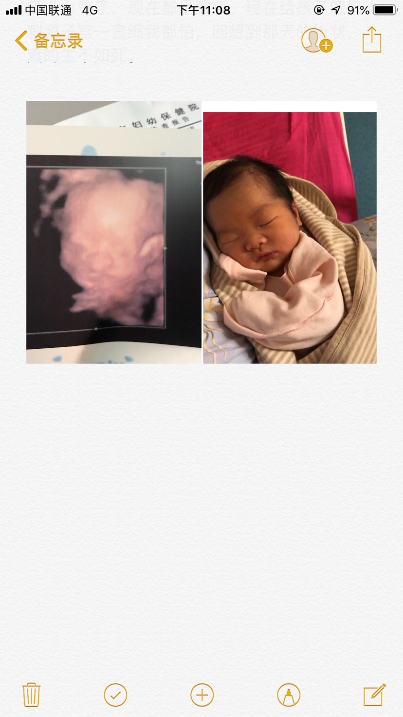 每个人的身体疼痛不一样，体质也不一样，只是我是这样的，没有吓人的意思，心里很难受想诉说出来。终于体会到了从女孩成为妈妈的过程，很艰辛，很不容易。