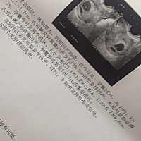 好多关注我的朋友和评论我帖子的朋友：，很遗憾没有给你们带来正能量！我也难逃这一劫！ 。。。今天去检...