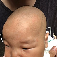 有谁知道宝宝额头周围和眉毛上的白点是什么？