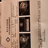 大家帮我看下，应该怎么办？好想要这个孩子