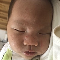 最近几天皮肤变得好干燥都脱皮了，是不是太干燥皮肤痒？老是用手抓来抓去都抓伤了😣😣