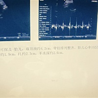 孕妈们谁帮我看看是男孩女孩啊~我是看不懂。