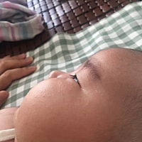 这是湿疹吗？感觉不太像啊，抹了地耐德好点，过两天就又起了，就穿一个小吊带啊，我们这里也不热，从出...