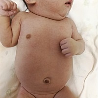 宝宝身上好多红点，是啥呀？该怎么处理呀？是热的吗？