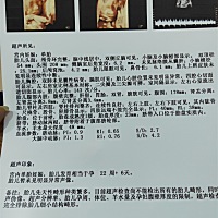 有经验的宝妈帮我看看是男宝宝还是女宝宝😂😂😂😃