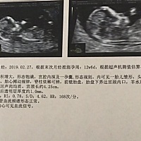 看男女，会看的帮忙看一下