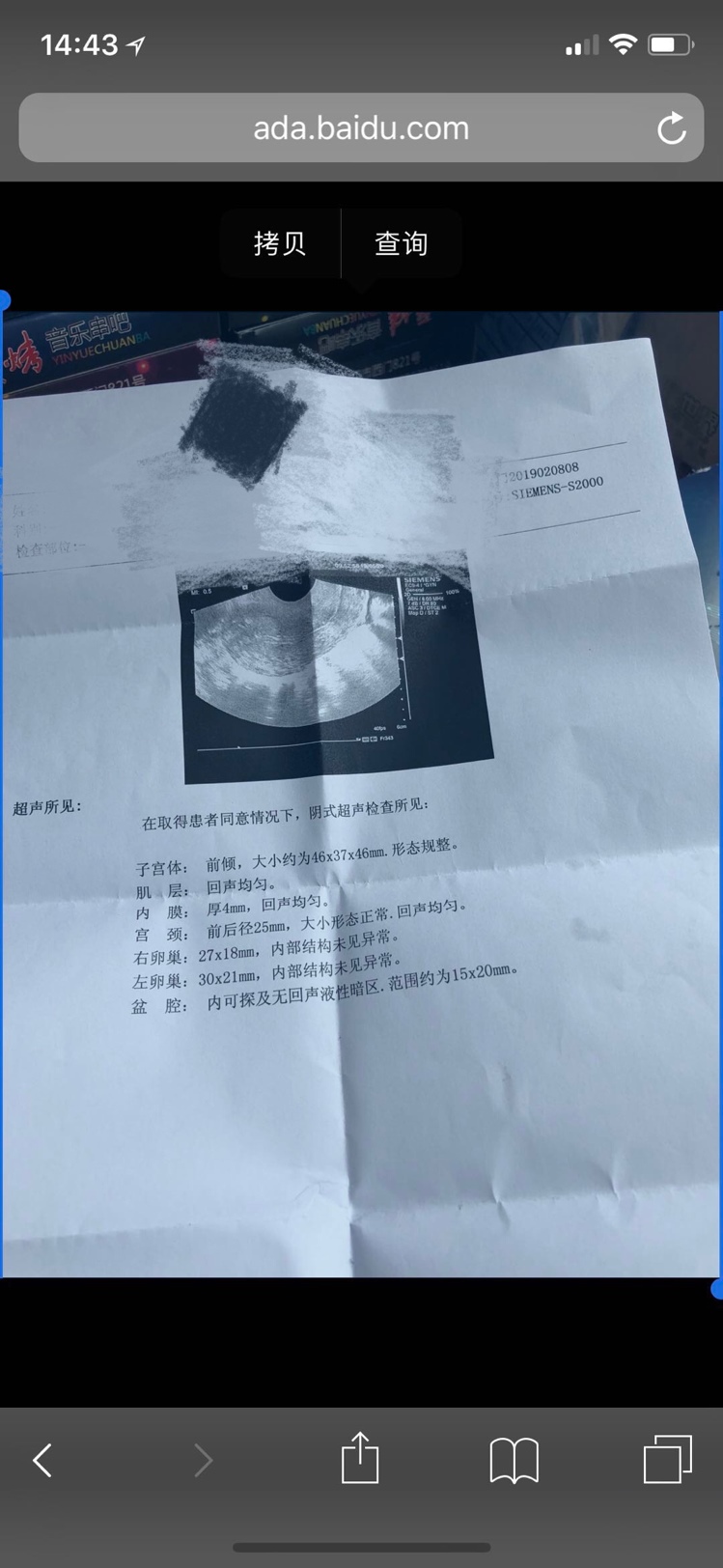 有懂的帮忙看下 谢谢了