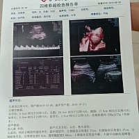 昨天做的四维，胆囊偏小，有关系吗？懂的宝妈顺便看下是儿孑还是公举？