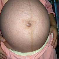 马上就要卸货了，大家能看出是男宝还是女宝吗？求解……