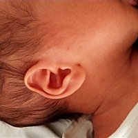 请问宝宝身上长得是什么，怎么缓解！