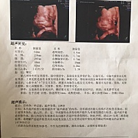 四维顺利通过，有没有会看男女的孕妈？纯属好奇