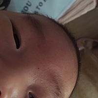 有妈妈知道这是怎么了嘛？怎么办呢？求助