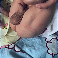 宝贝身上出现小红点谁能知道这是什么，起了之后，又下去，然后别的地方又起，我都着急死了