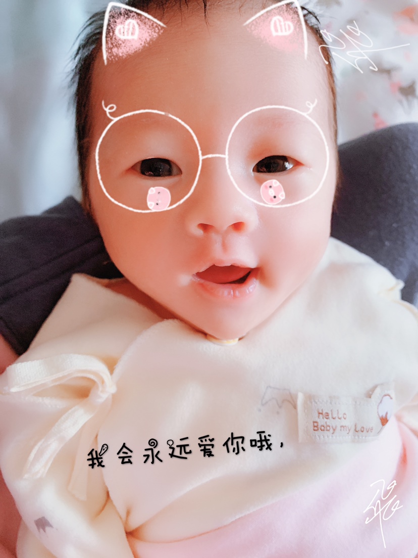 26天啦，黄疸退了，变白了。