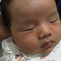 宝妈们，孩子生下来就进保温箱，回来就这样，看一下孩子右眼皮这里是不是胎记啊？