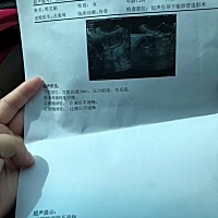 输卵管堵塞，不知道该选择什么了，腹腔镜手术和试管婴儿，不知道该选择什么