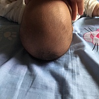我家两个月宝宝头型怎么那么长啊 上窄下宽 应该怎么睡啊 宝妈会看帮我支招一下吧 愁人 啊 人家孩子头型...