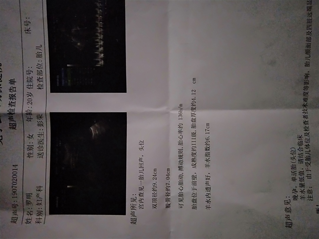 胎盘成熟度3级了，谁知道还有多久生产