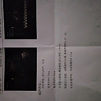 末次月经9.24，孕产期6.30号的现在已经超孕产期三天了还是没有反应，昨天是打彩超医生说羊水少，我想快...