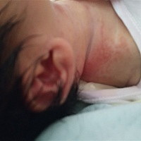 宝妈们问一下这是什么红红的，第一次做妈什么都不懂